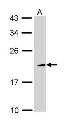 TIA-1 Polyclonal Antibody, Invitrogen 100 &mu;L | Buy Online | Invitrogen | Fisher Scientific