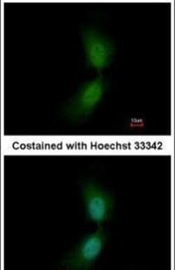 SUFU Polyclonal Antibody, Invitrogen 100 &mu;L; Unconjugated:Antibodies,