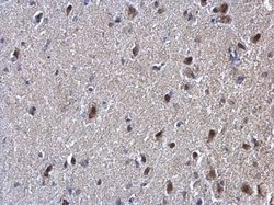 SUFU Polyclonal Antibody, Invitrogen 100 &mu;L; Unconjugated:Antibodies,