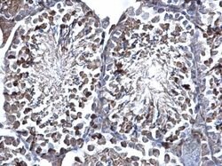 SUFU Polyclonal Antibody, Invitrogen 100 &mu;L; Unconjugated:Antibodies,