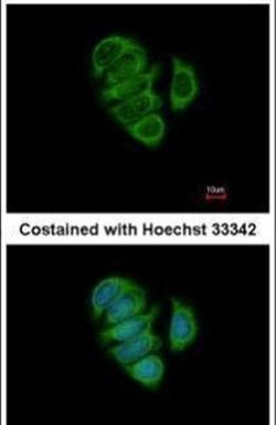 CaMKK beta Rabbit anti-Human, Mouse, Polyclonal, Invitrogen 100 &mu;L;