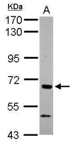 CaMKK beta Rabbit anti-Human, Mouse, Polyclonal, Invitrogen 100 &mu;L;