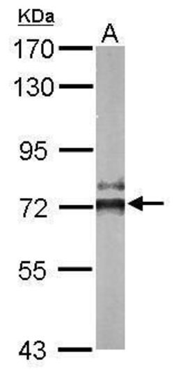 CaMKK beta Rabbit anti-Human, Mouse, Polyclonal, Invitrogen 100 &mu;L;