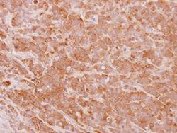 PHF17 Polyclonal Antibody, Invitrogen 100 &mu;L; Unconjugated:Antibodies,