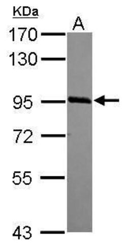 PHF17 Polyclonal Antibody, Invitrogen 100 &mu;L; Unconjugated:Antibodies,