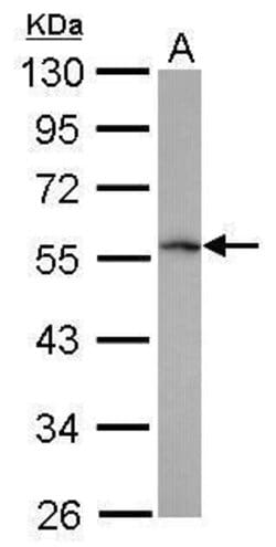 TRIM62 Rabbit anti-Human, Polyclonal, Invitrogen 100 &mu;L; Unconjugated:Antibodies,