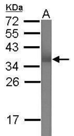 TRIM62 Rabbit anti-Human, Polyclonal, Invitrogen 100 &mu;L; Unconjugated:Antibodies,