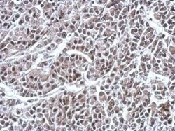 RNF180 Polyclonal Antibody, Invitrogen 100 &mu;L | Buy Online | Invitrogen | Fisher Scientific