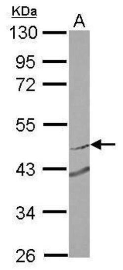 RNF180 Polyclonal Antibody, Invitrogen 100 &mu;L | Buy Online | Invitrogen | Fisher Scientific
