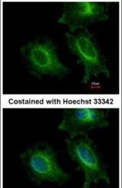ITFG1 Rabbit anti-Human, Polyclonal, Invitrogen 100 &mu;L; Unconjugated:Antibodies,