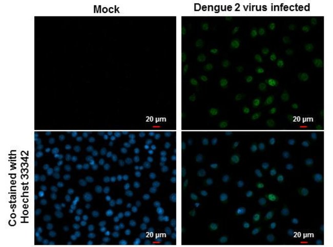 Dengue Virus Type 2 NS5 Rabbit anti-Virus, Polyclonal, Invitrogen 100 ...