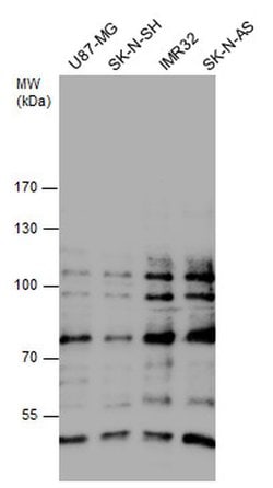 GLI1, Polyclonal, Invitrogen 100&mu;L; Unconjugated:Antibodies, Polyclonal