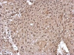 GLI1, Polyclonal, Invitrogen 100&mu;L; Unconjugated:Antibodies, Polyclonal