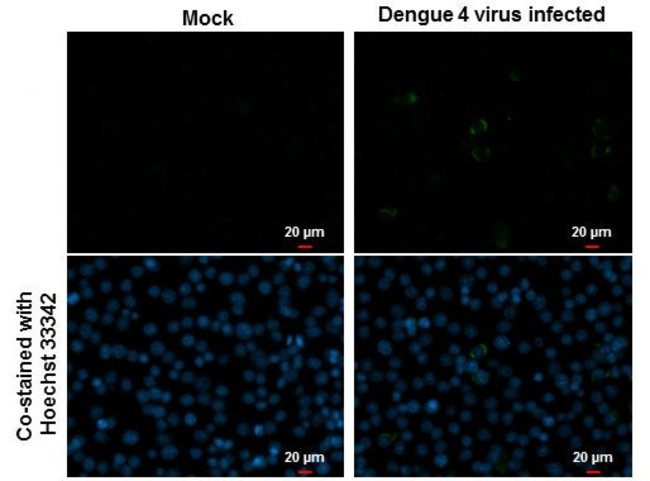 Dengue Virus Type 2 NS1 Rabbit anti-Virus, Polyclonal, Invitrogen 100 ...