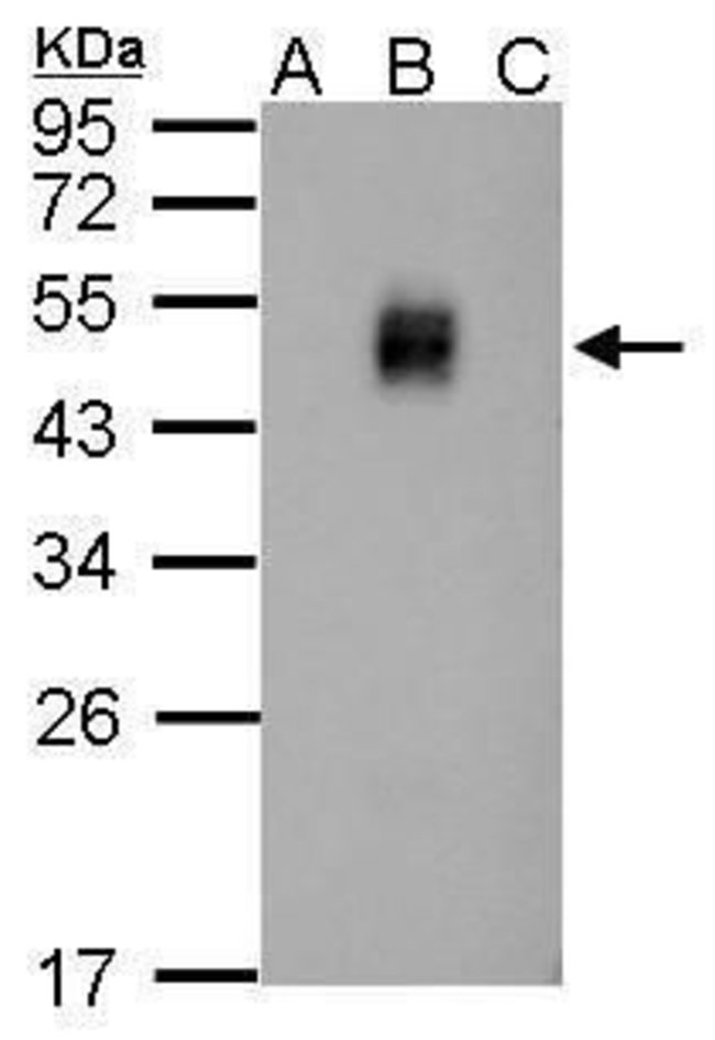 Dengue Virus Type 2 NS1 Rabbit anti-Virus, Polyclonal, Invitrogen 100 ...