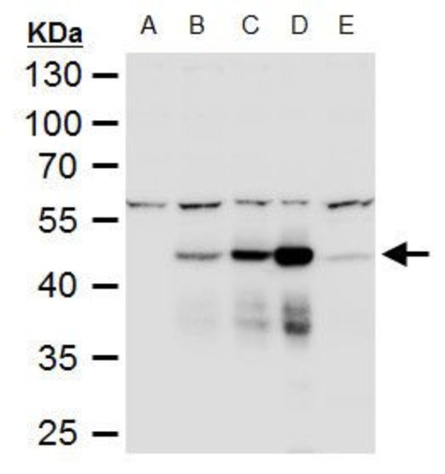 Dengue Virus Type 2 NS1 Rabbit anti-Virus, Polyclonal, Invitrogen 100 ...