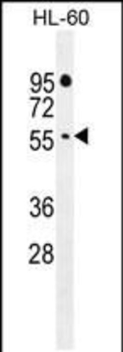 FBXW11 Rabbit anti-Human, Polyclonal, Invitrogen 400 &mu;L | Buy Online | Thermo Scientific | Fisher Scientific