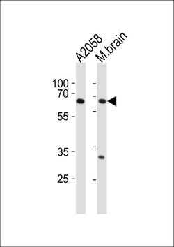LZTS1 Rabbit anti-Human, Mouse, Polyclonal, Invitrogen 400 &mu;L; Unconjugated:Antibodies,