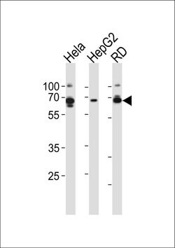 AMPK gamma-3 Rabbit anti-Human, Polyclonal, Invitrogen 400 &mu;L; Unconjugated:Antibodies,