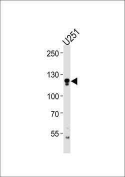 ECE2 Rabbit anti-Human, Polyclonal, Invitrogen 400 μL; Unconjugated:Antibodies,