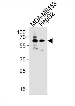 BTRC Rabbit anti-Human, Polyclonal, Invitrogen 400 &mu;L; Unconjugated:Antibodies,