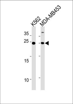 SSPN Rabbit anti-Human, Polyclonal, Invitrogen 400 &mu;L; Unconjugated:Antibodies,