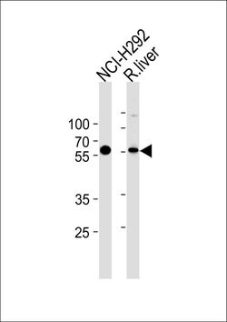 MCCC2 Rabbit anti-Human, Mouse, Rat, Polyclonal, Invitrogen 400 &mu;L;