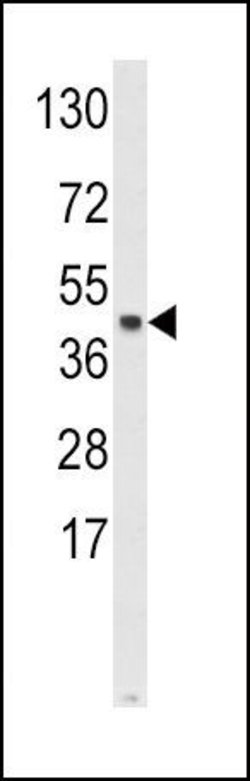 SKP2 Rabbit anti-Human, Polyclonal, Invitrogen 400 &mu;L; Unconjugated:Antibodies,