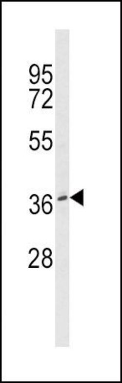 BMI-1 Rabbit anti-Human, Polyclonal, Invitrogen 400 μL; Unconjugated:Antibodies,