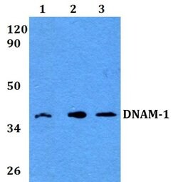 Invitrogen CD226 Polyclonal Antibody 100 μL; Unconjugated:Antibodies,