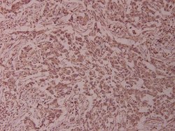 Invitrogen ADD1/ADD2 Polyclonal Antibody 100 &mu;L; Unconjugated:Antibodies,