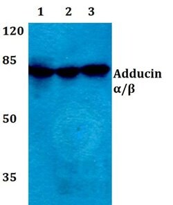 Invitrogen ADD1/ADD2 Polyclonal Antibody 100 &mu;L; Unconjugated:Antibodies,