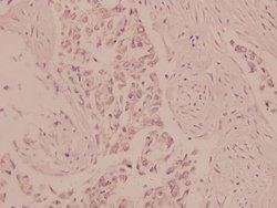 Invitrogen AMPK alpha-1,2 Polyclonal Antibody 100 &mu;L; Unconjugated:Antibodies,