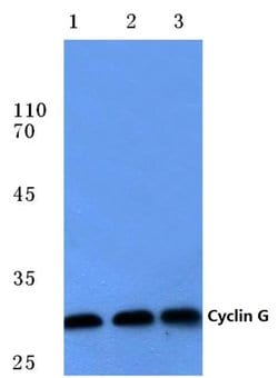 Invitrogen Cyclin G1 Polyclonal Antibody 100 &mu;L; Unconjugated:Antibodies,