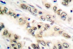 Invitrogen E2F4/E2F5 Polyclonal Antibody 100 &mu;L; Unconjugated:Antibodies,
