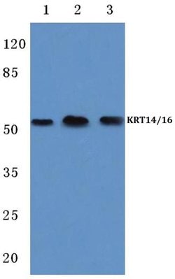 Cytokeratin 14/16 Polyclonal Antibody, Invitrogen 100 &mu;L | Buy Online | Invitrogen | Fisher Scientific