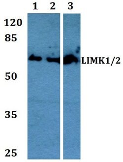 Invitrogen LIMK1/LIMK2 Polyclonal Antibody 100 &mu;L; Unconjugated:Antibodies,