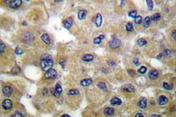 Invitrogen Mammaglobin B Polyclonal Antibody 100 &mu;L | Buy Online | Invitrogen&trade; | Fisher Scientific