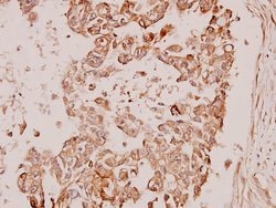 Invitrogen PDPK1 Polyclonal Antibody 100 &mu;L; Unconjugated:Antibodies,