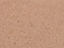 Invitrogen FOXO1/FOXO3/FOXO4 Polyclonal Antibody 100 &mu;L; Unconjugated:Antibodies,