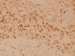 Invitrogen MSK1 Polyclonal Antibody 100 &mu;L; Unconjugated:Antibodies,