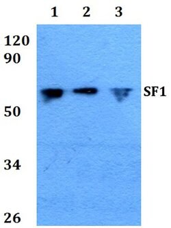 Invitrogen SF1 Polyclonal Antibody 100 &mu;L; Unconjugated:Antibodies,