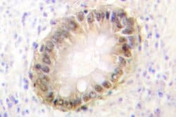 Invitrogen SMAD2/SMAD3 Polyclonal Antibody 100 &mu;L; Unconjugated:Antibodies,