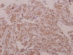 LZK Polyclonal Antibody, Invitrogen 100 &mu;L; Unconjugated:Antibodies,