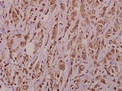 Invitrogen AKAP10 Polyclonal Antibody 100 &mu;L; Unconjugated:Antibodies,