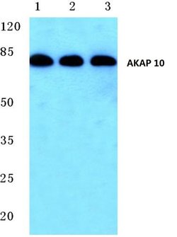Invitrogen AKAP10 Polyclonal Antibody 100 &mu;L; Unconjugated:Antibodies,