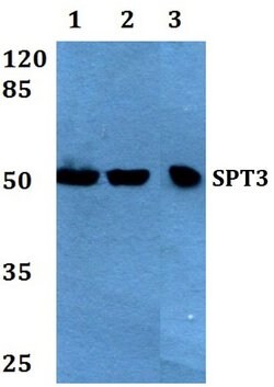 SPT3 Polyclonal Antibody:Antibodies, Polyclonal