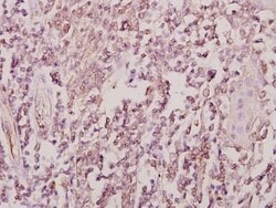 Invitrogen ZRANB2 Polyclonal Antibody 100 &mu;L | Buy Online | Invitrogen&trade; | Fisher Scientific