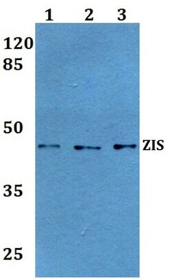 Invitrogen ZRANB2 Polyclonal Antibody 100 &mu;L | Buy Online | Invitrogen&trade; | Fisher Scientific