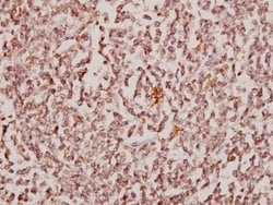 CBX6 Polyclonal Antibody:Antibodies, Polyclonal